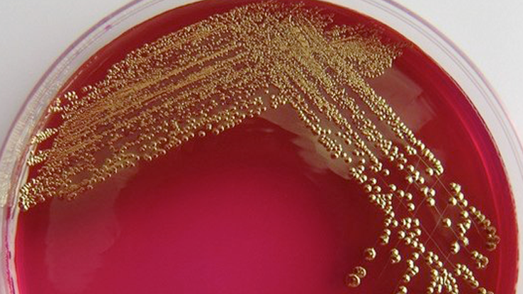 Biomineralized gold left by the bacterium.