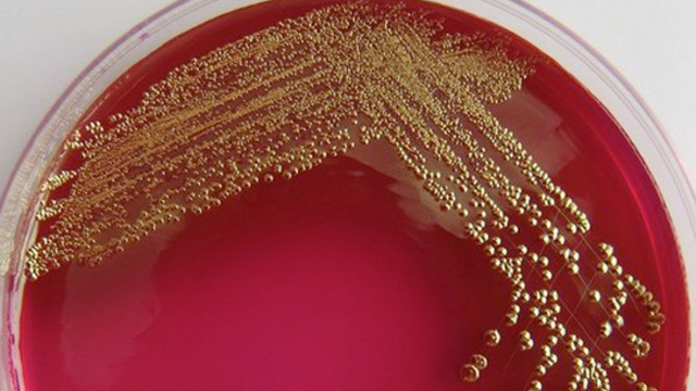 Biomineralized gold left by the bacterium.